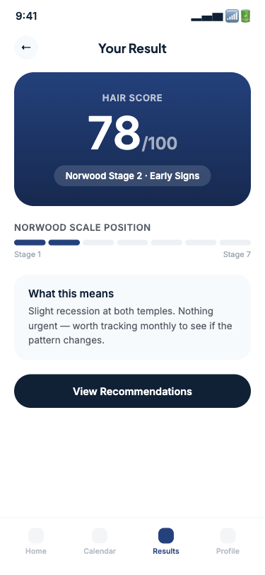 AI result screen showing Hair Score and Norwood stage