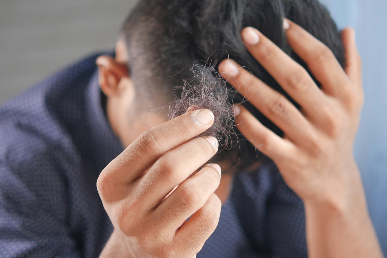 Close-up of shed hair in a man's hand after running fingers through hair