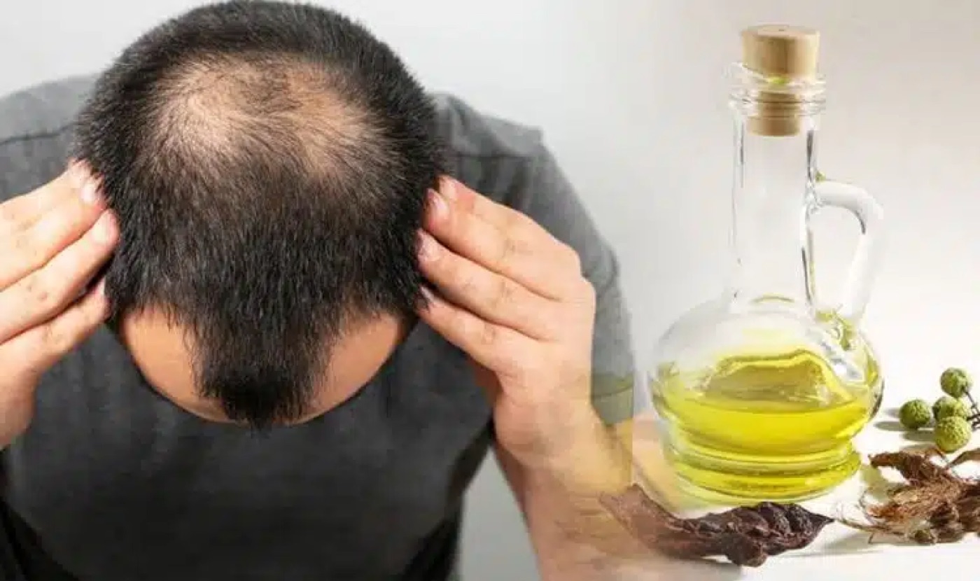 Man checking his hairline next to a bottle of olive oil